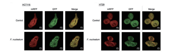 The principle of mRFP-GFP-LC3