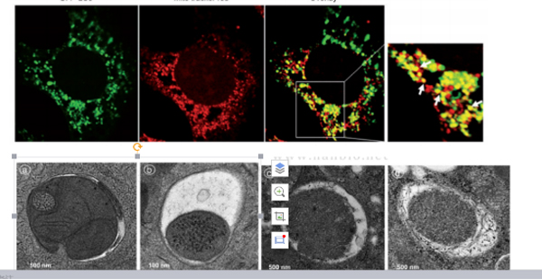 Mitophagy Detection 